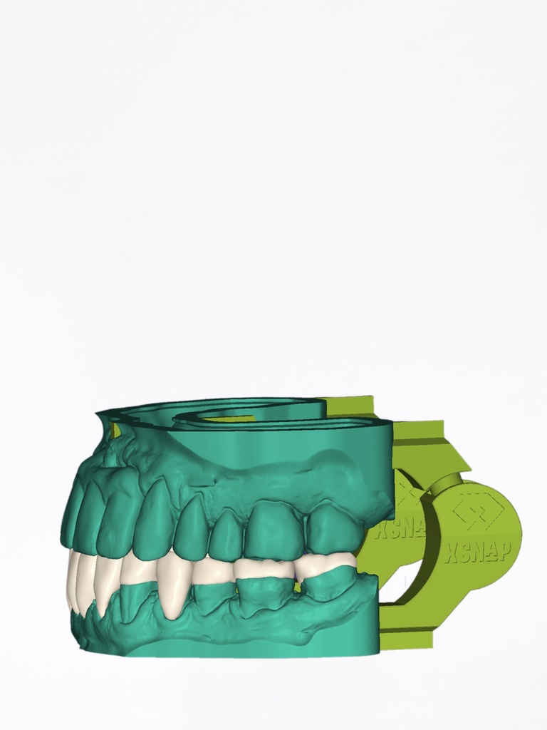 DentalCAD - Modulo xSNAP per Model Creator Stand Alone
