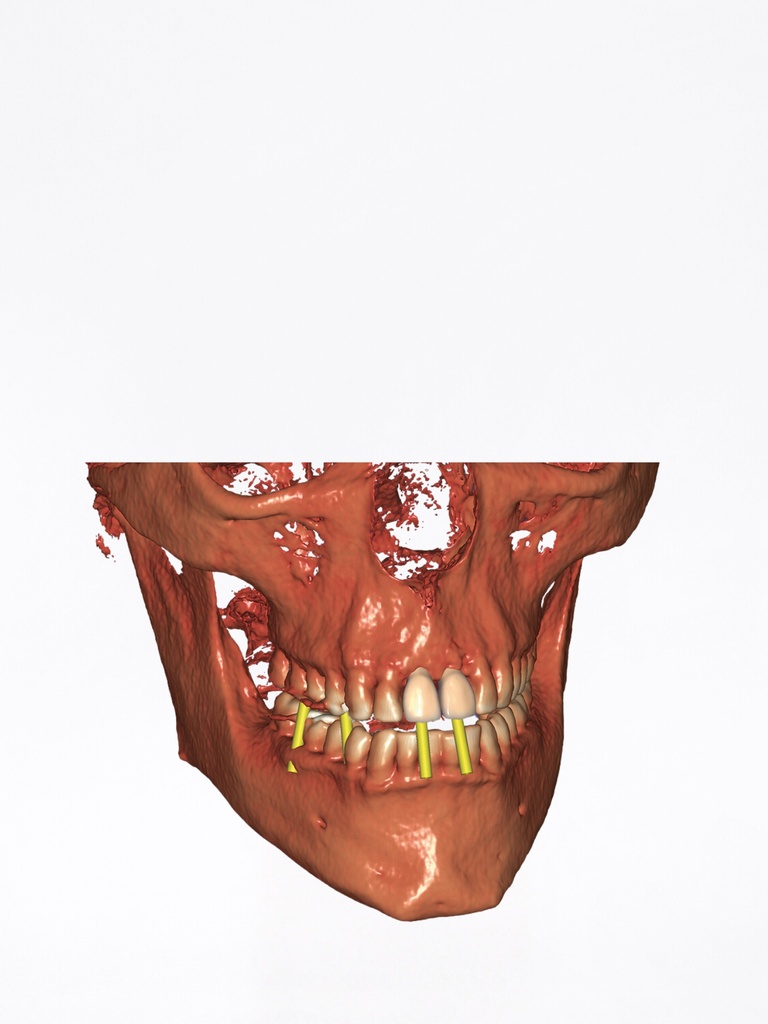 DentalCAD - Modulo DICOM Viewer