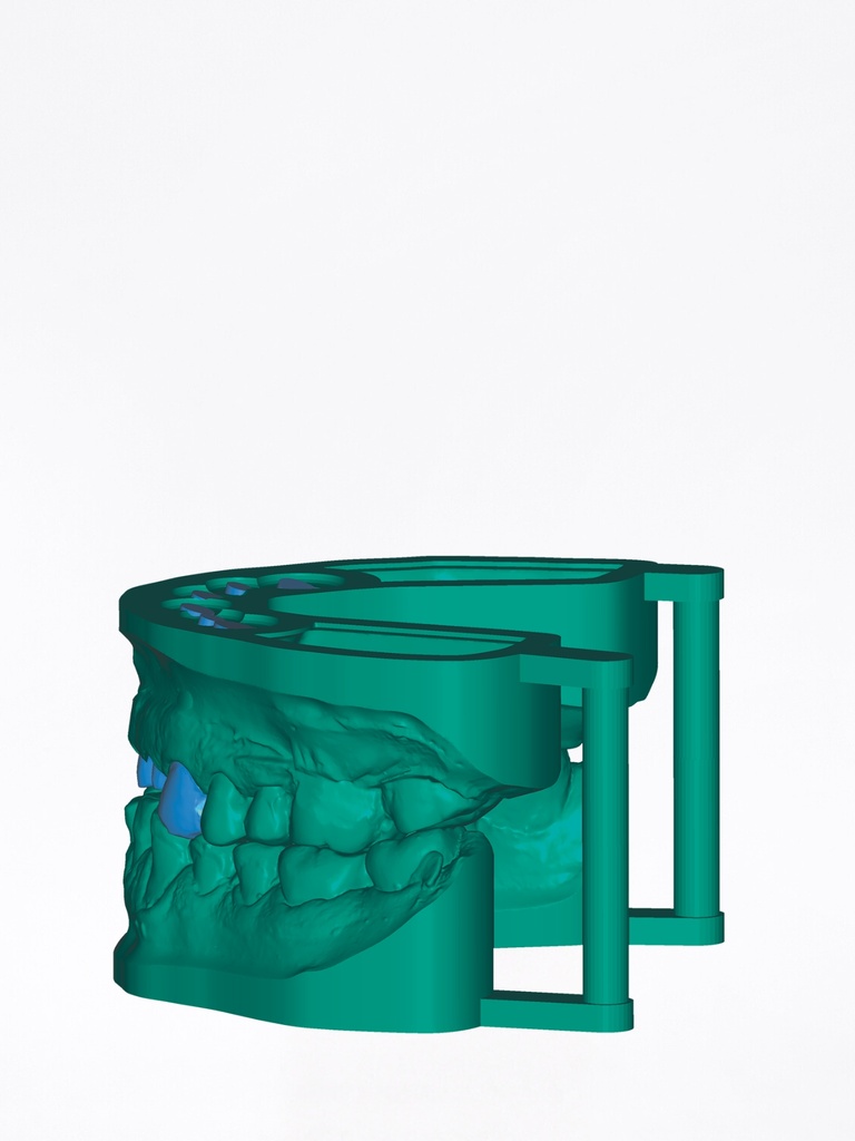 DentalCAD - Modulo Model Creator Stand Alone