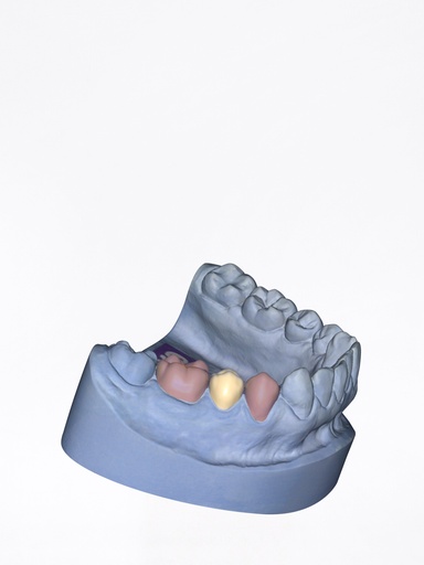 ChairsideCAD - Modulo Provvisori