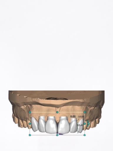 ChairsideCAD - Modulo Smile Creator incl. TruSmile Stand Alone