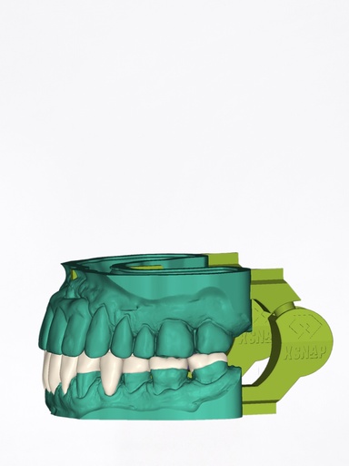 DentalCAD - Modulo xSNAP Flex
